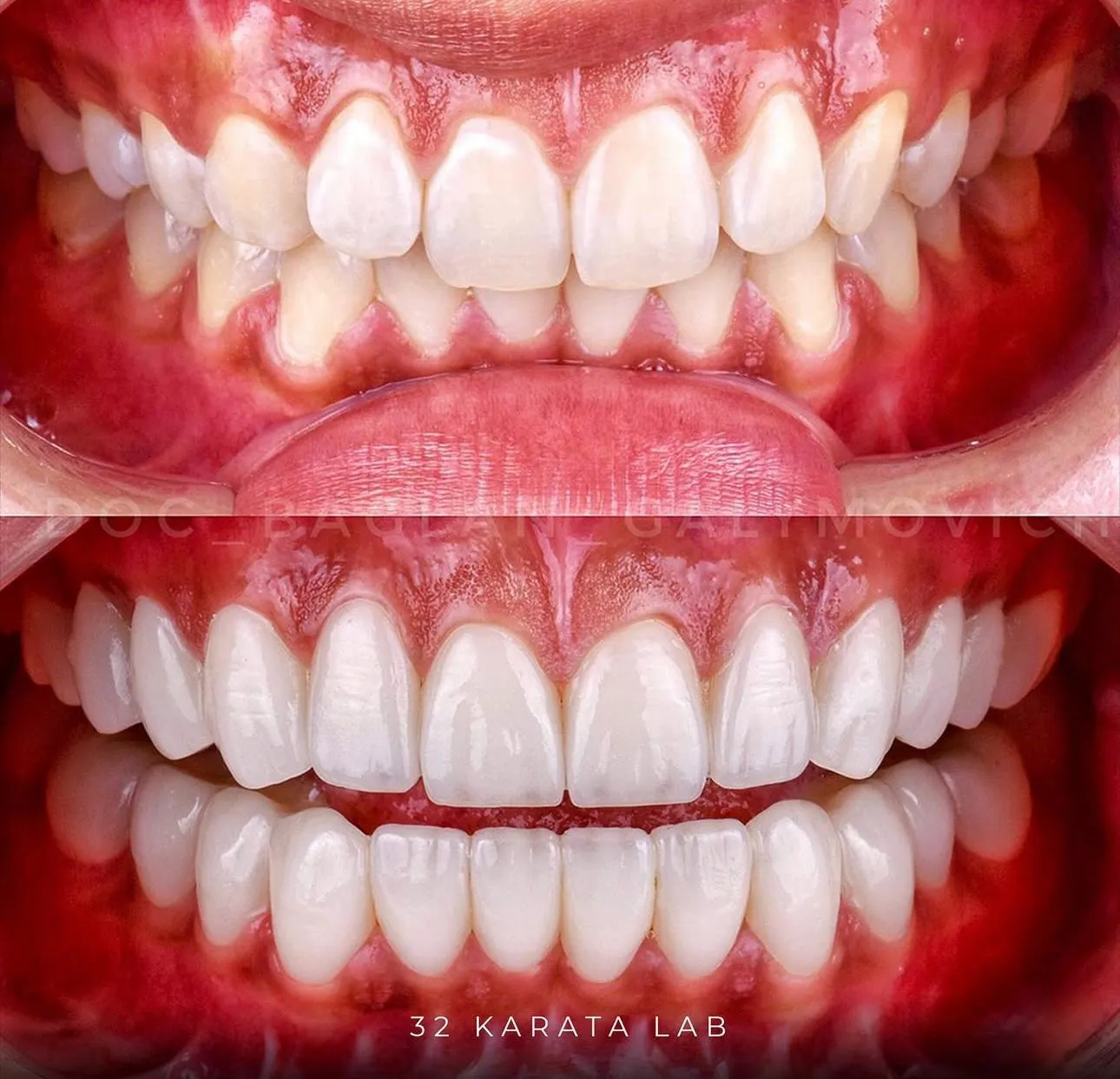 Зуботехническая лаборатория "32 Karata"