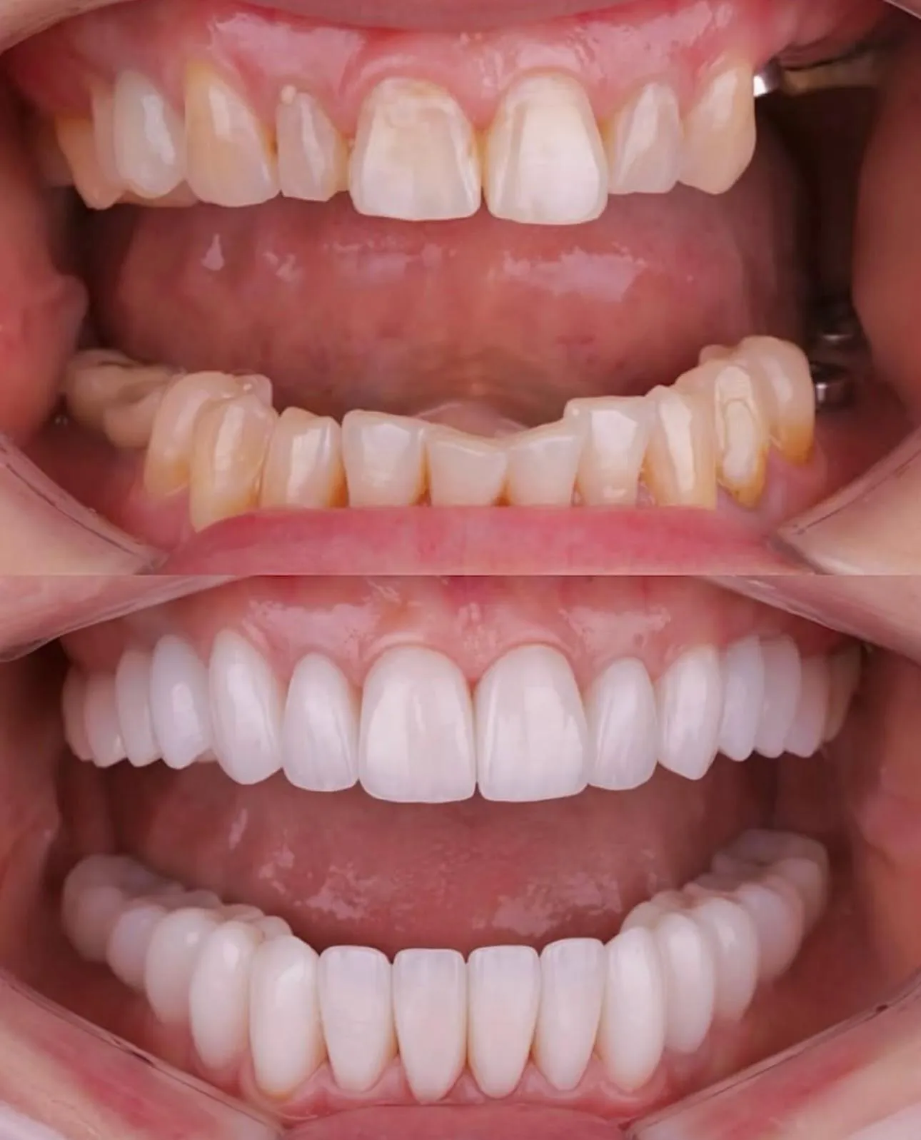 Зуботехническая лаборатория "Umbetov Dental"