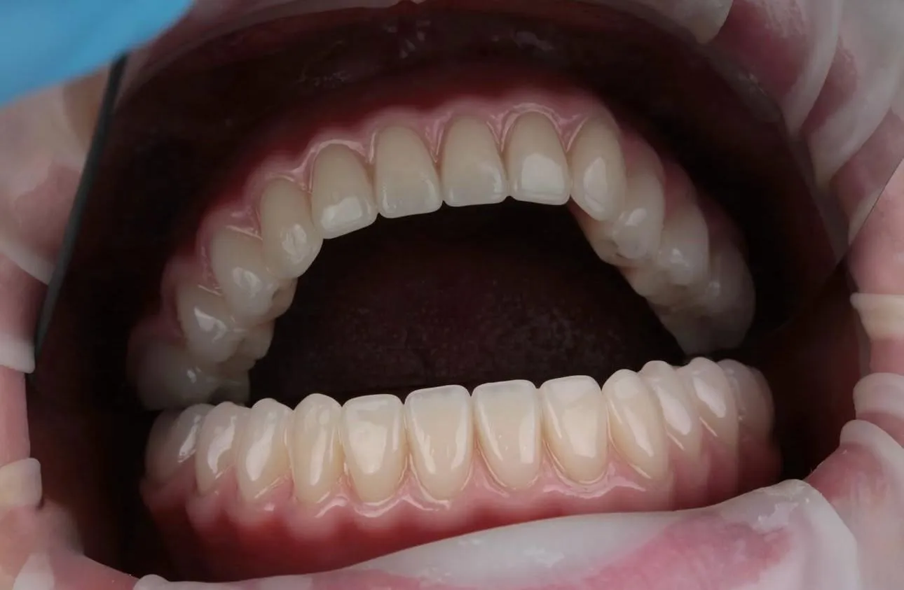 Зуботехническая лаборатория "Aza Teh1"