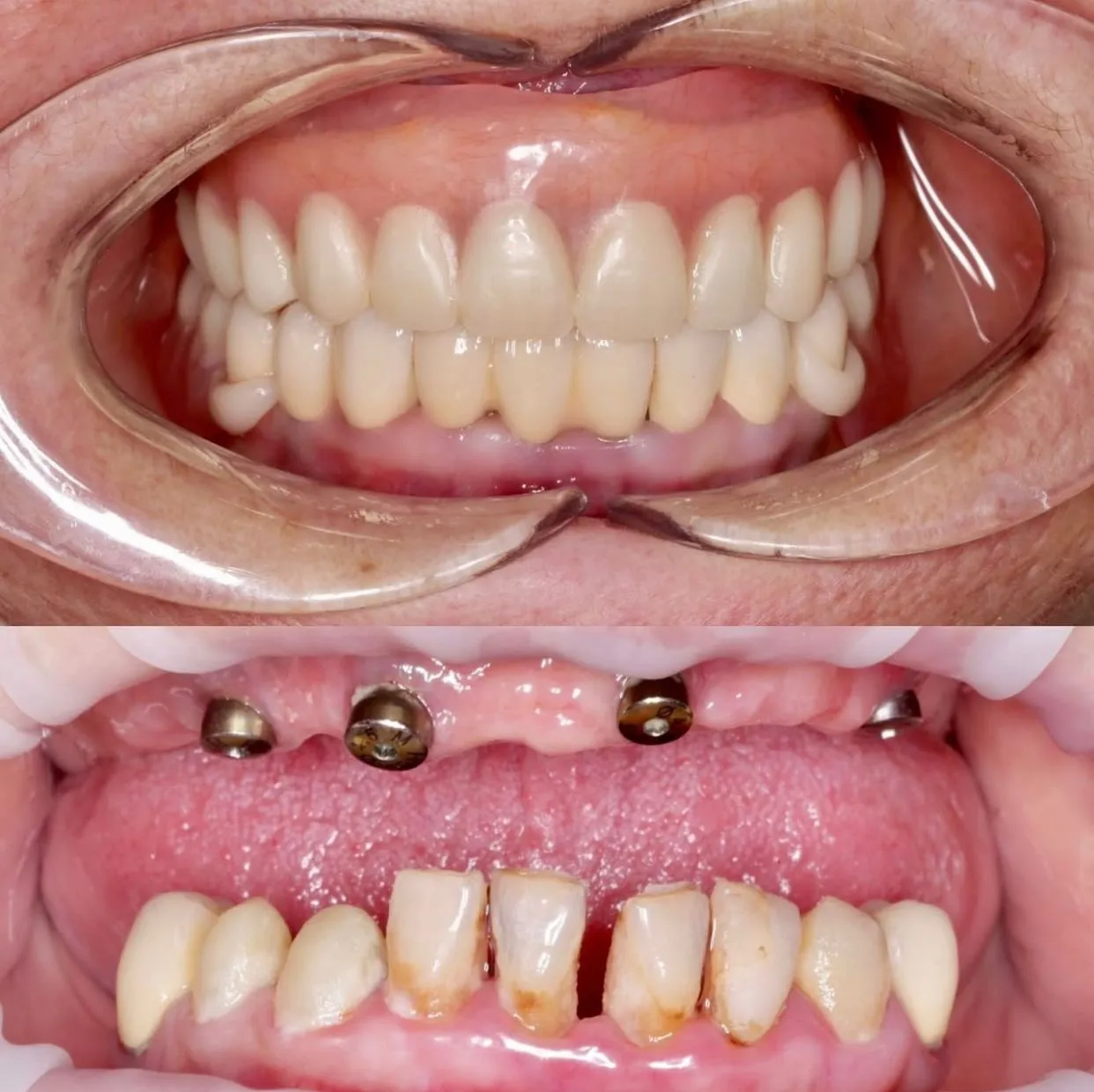 Зуботехническая лаборатория "Precision Lab"