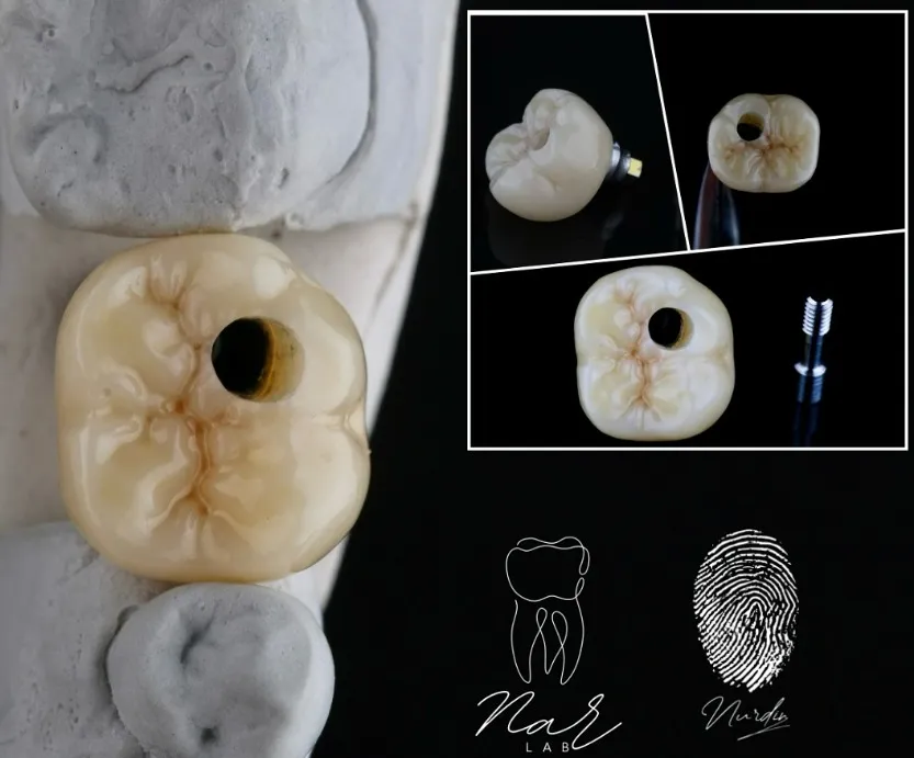 Зуботехническая лаборатория "Narlab 2024"
