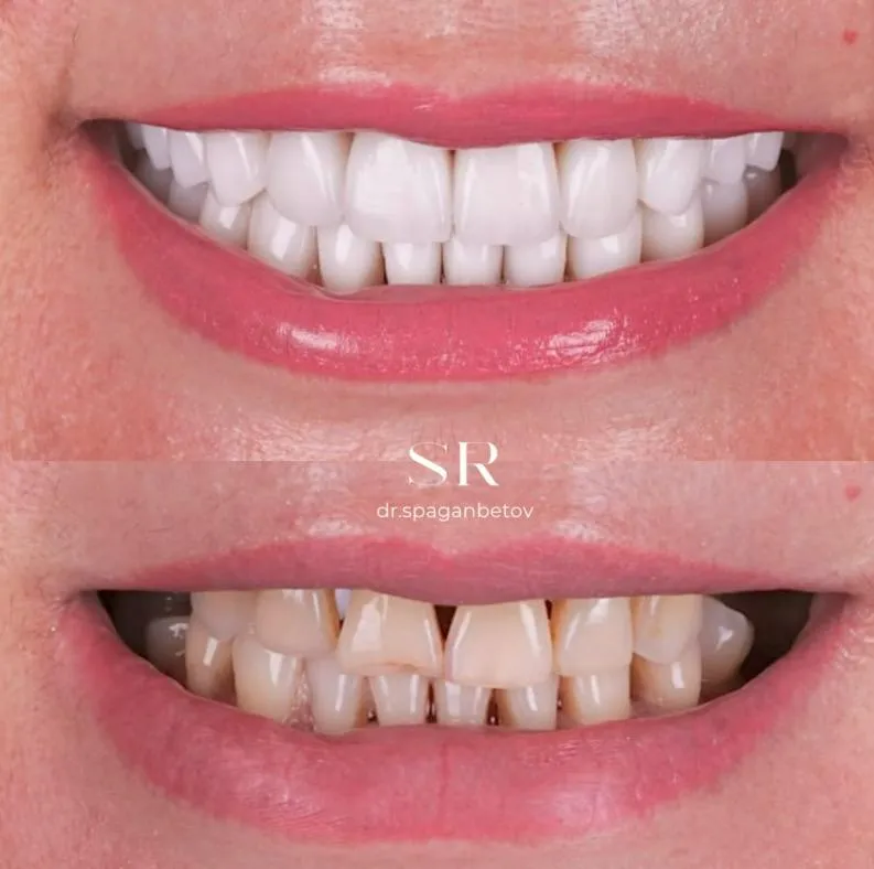 Зуботехническая лаборатория "Umbetov Dental"