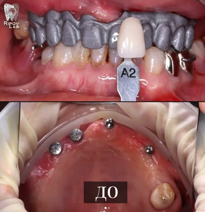 Зуботехническая лаборатория "Ripov Lab"