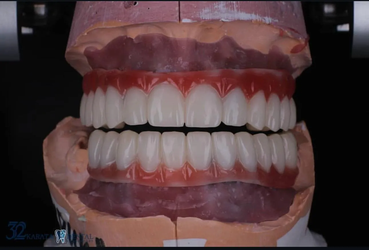 Зуботехническая лаборатория "32 Karata"