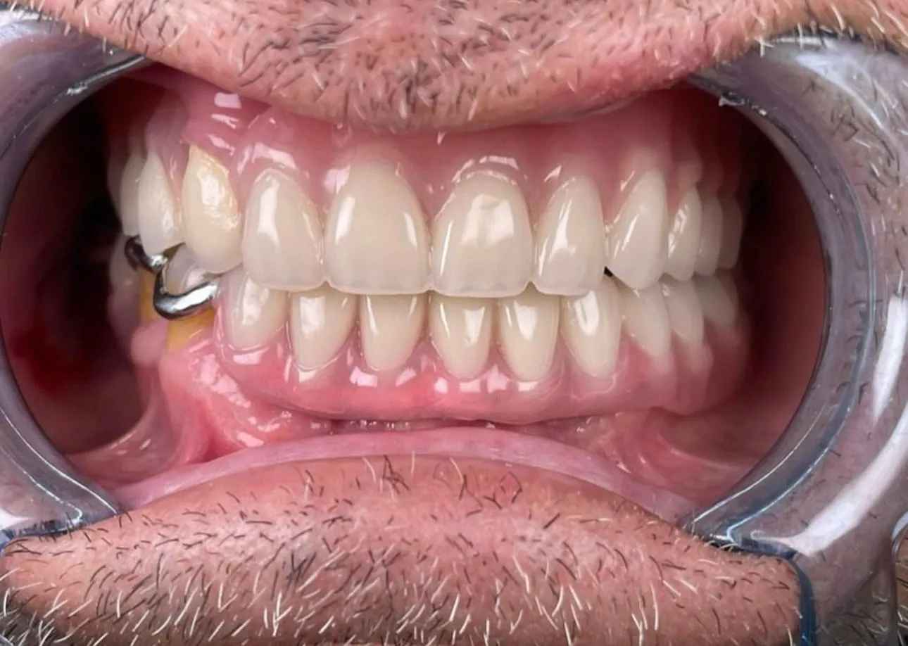 Зуботехническая лаборатория "Aza Teh1"