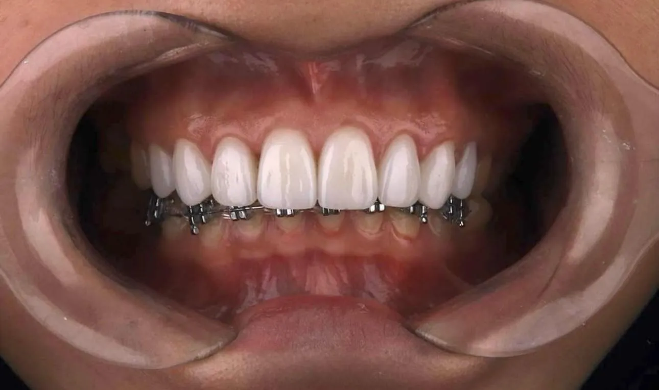 Зуботехническая лаборатория "Umbetov Dental"