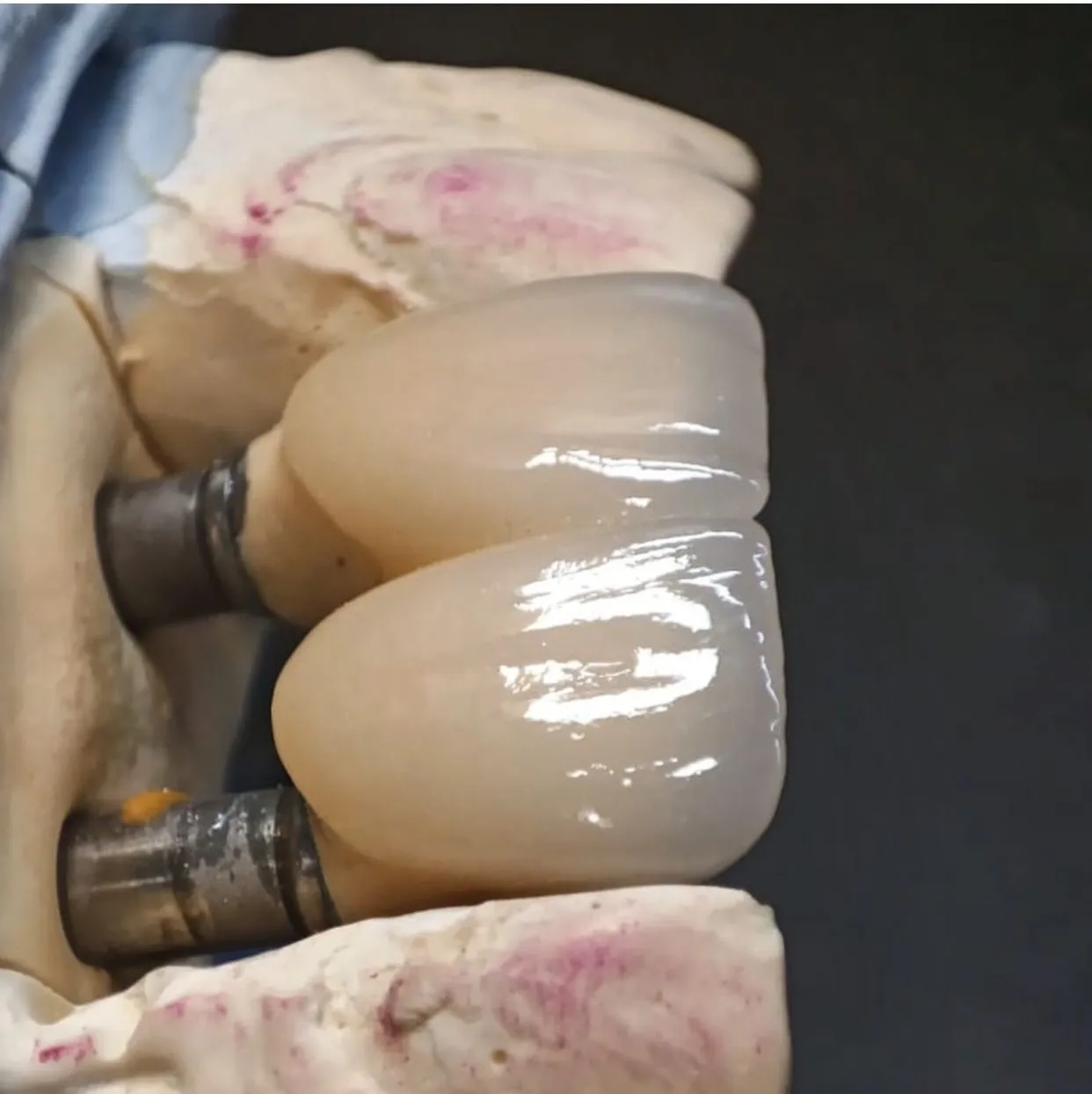 Зуботехническая лаборатория "Precision Lab"