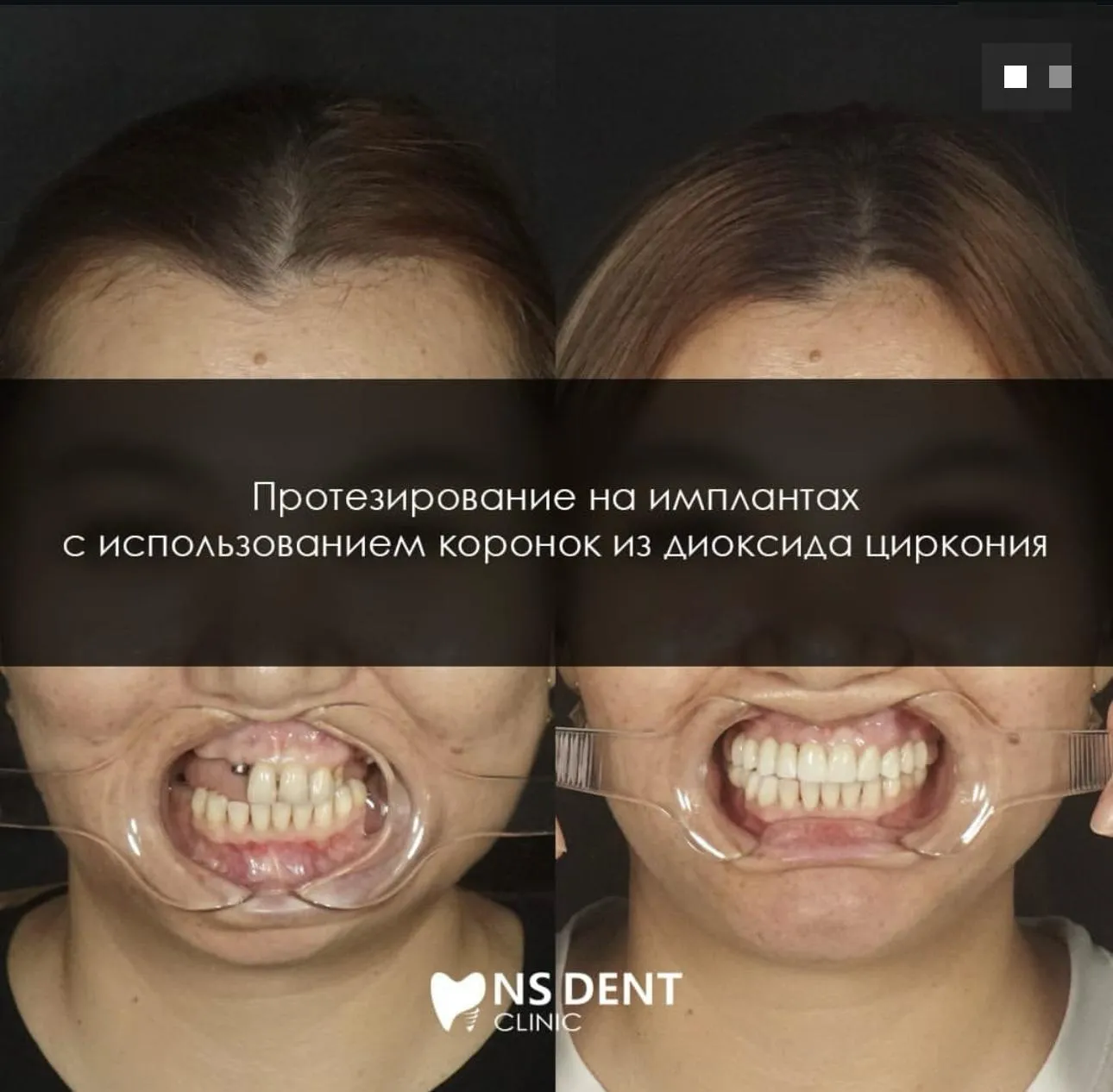 Цифровая лаборатория "NSLAB"