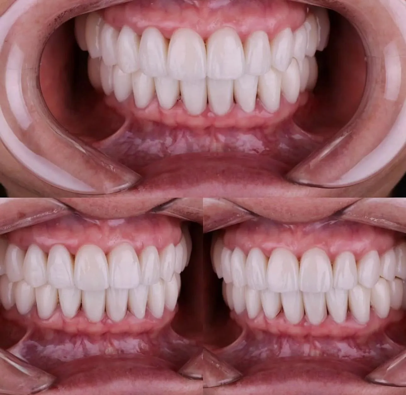 Зуботехническая лаборатория "Umbetov Dental"