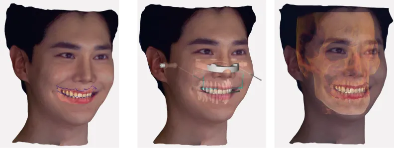 rayface_14.jpg