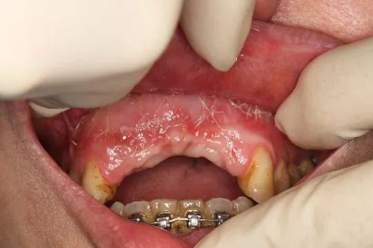 Хирургия мягких тканей.jpg