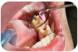 В стоматологии.jpg