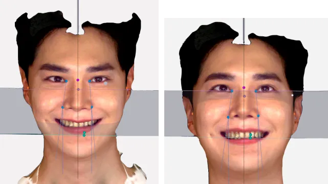 rayface_15.jpg