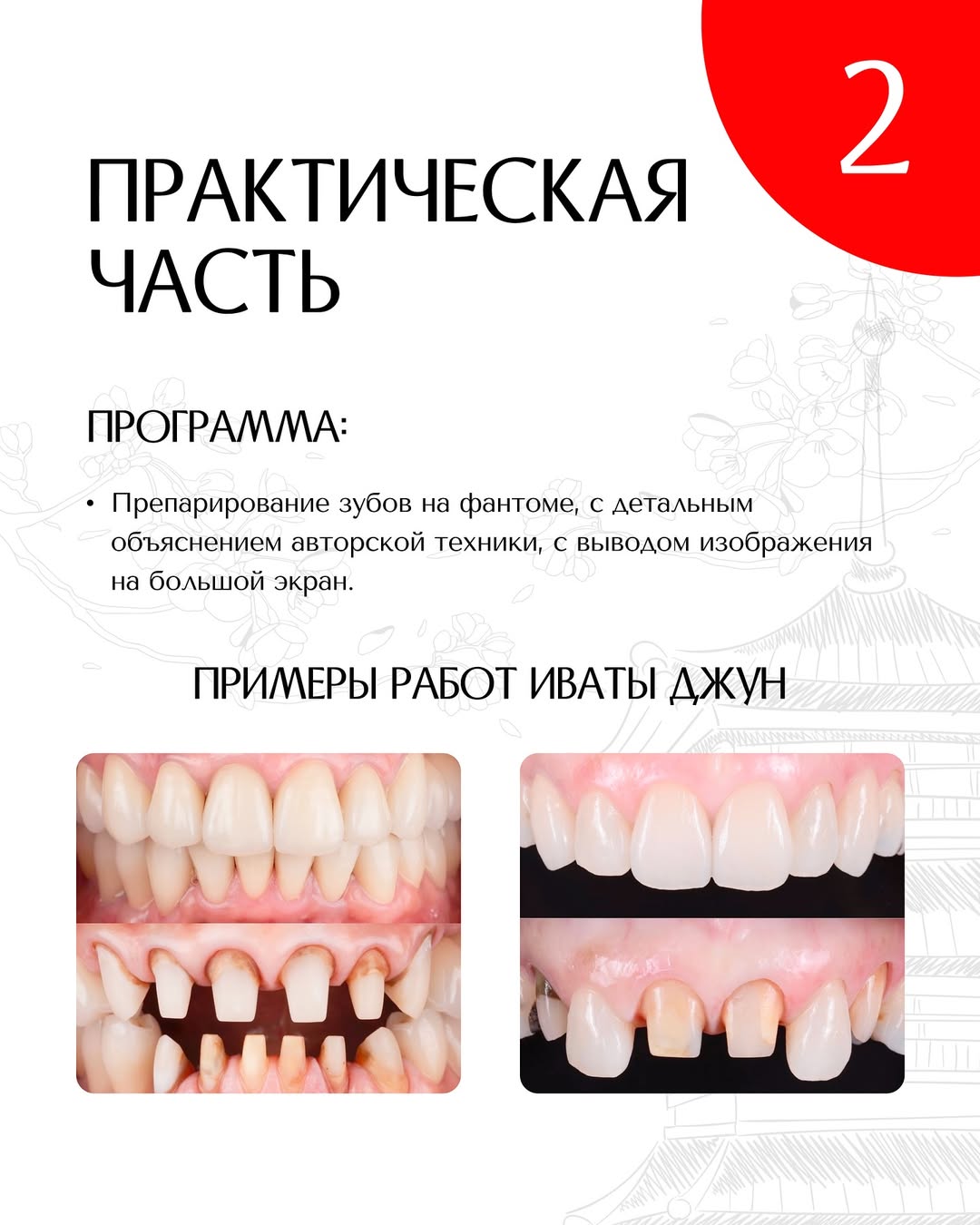 Искусство препарирования зубов