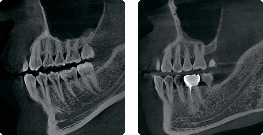 rayscan160_5.jpg rayscan160_5.jpg