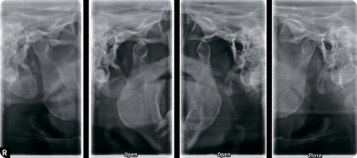 rayscan160_11.jpg rayscan160_11.jpg