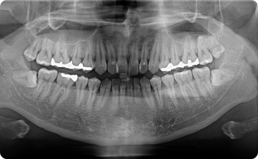 rayscan160_10.jpg rayscan160_10.jpg