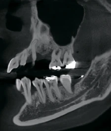 имплантация 2.jpg