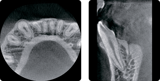 rayscan160_6.jpg rayscan160_6.jpg