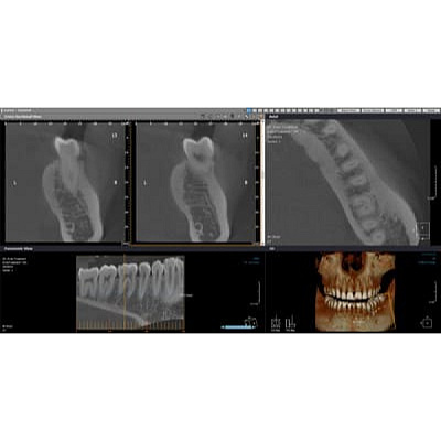 Компьютерный томограф RAYSCAN RCT 700