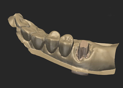 3D Сканер Edge HD-M
