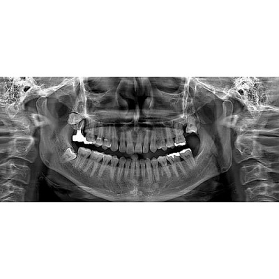 Компьютерный томограф RAYSCAN RCT 700